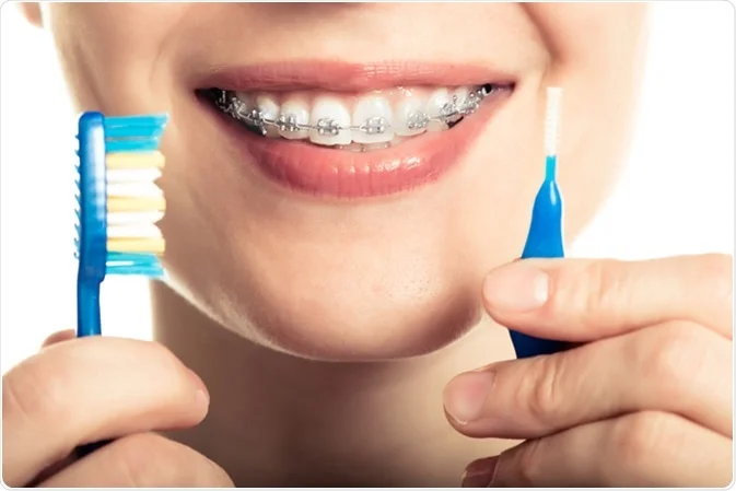 How Braces Accelerate Healing After Dental Trauma and Injury